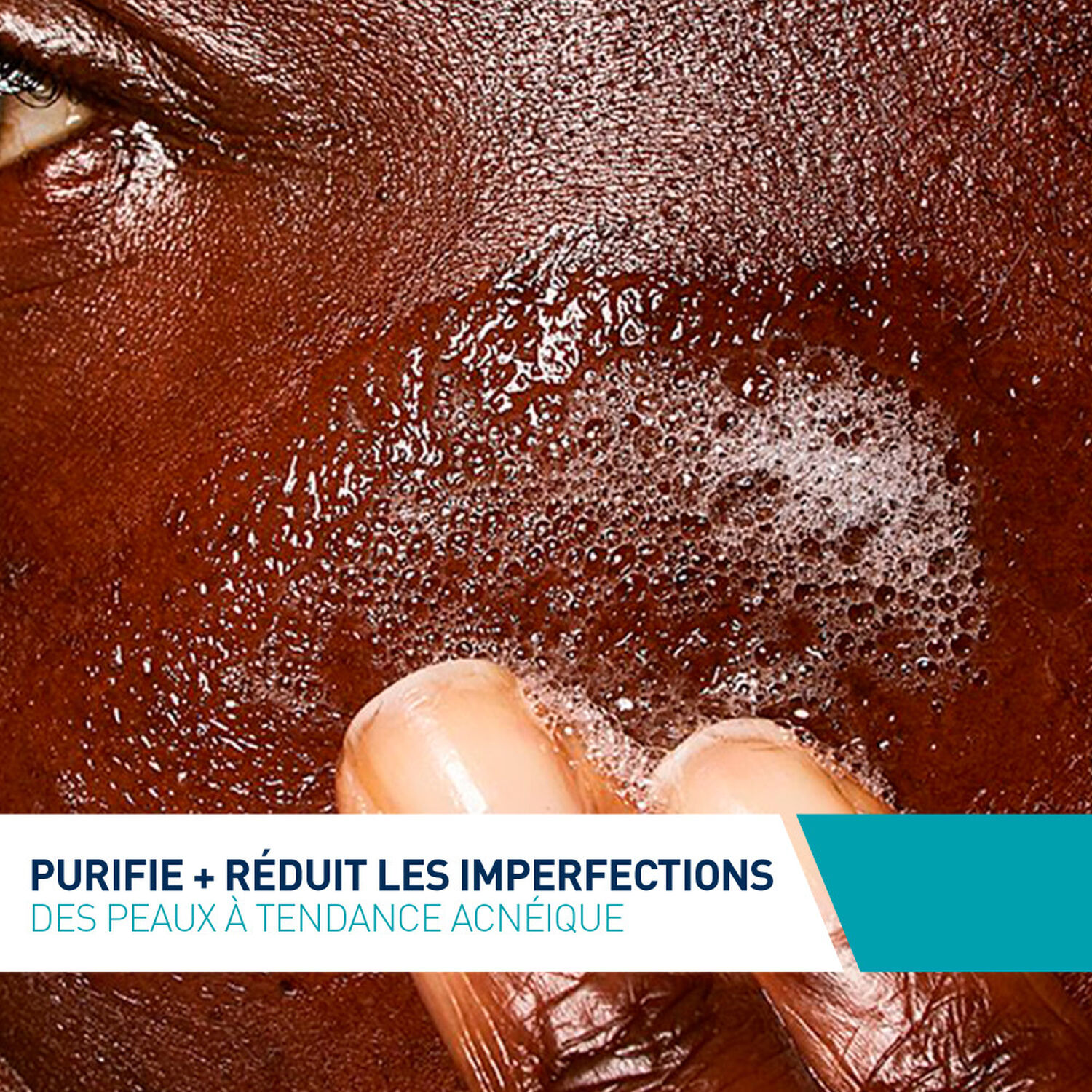 Anti Imperfections Gel Moussant Peaux Tendance Acn ique 236 Ml anti-imperfections-gel-moussant-peaux-tendance-acn-ique-236-ml