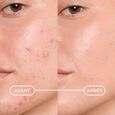 S&eacute;bium K&eacute;rato+Cover Hoge Verdraagzaamheid Anti-Imperfectie Getinte Gel-Cr&egrave;me 30 ml