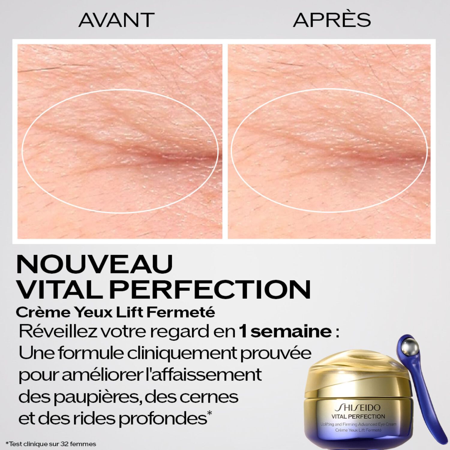 Crème Pour Les Yeux Shiseido – Effet Lift Fermenté – 15 Ml – Neuf