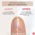 Nail Corrector Poderm