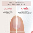 Nail Corrector Poderm