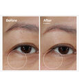 Lacto-PDRN* 4% + B9 Eye Cream The Ordinary