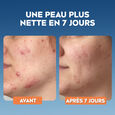 Derma Skin Clear Nivea