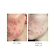 Violet Water BHA Clarifying Treatment Tonic Oskia