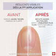 Nail Corrector Poderm