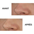Blackhead Solutions Clinique
