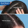 Kelual Squanorm Ducray