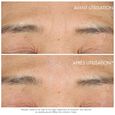 Capture Totale Hyalushot Dior