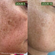 [Active-Lift] Das vereinheitlichende Anti-Pigmentflecken-Serum 30 ml