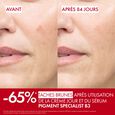 Liftactiv B3 Vichy