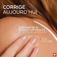 Nail Corrector Poderm
