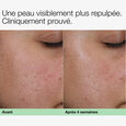 Clinique Smart Clinical Repair&trade; Clinique