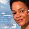 Q10 Anti-Rides Power Nivea