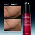 Pro-Collagen Micro-Growth Factor Filorga