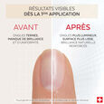 Nail Corrector Poderm