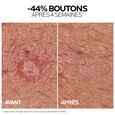 Effaclar Duo+M La Roche-Posay