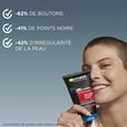 SkinActive Pure Active Intensiv 3-i-1 mod urenheder og hudorme 150 ml