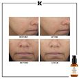 Powerful-Strength Line-Reducing Concentrate Kiehl's