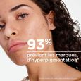 S&eacute;bium Kerato+ SPF30 Borhib&aacute;k elleni v&eacute;do g&eacute;l-kr&eacute;m magas toleranci&aacute;val 30ml