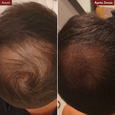 Tricho-Boost Anti-Hair Loss Serum Treatment 3&times;20 ml