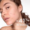 SEBIUM KERATO+ Zel-krem przeciw niedoskonalosciom 30 ml