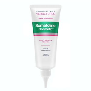 Correction Vergetures