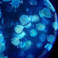Biovergetures Prevence a redukce stri&iacute;