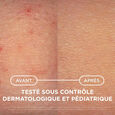 Atoderm Ad Intensive Baume Bioderma