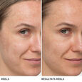 Confidence in a Cream&trade; Supercharged Hidrat&aacute;l&oacute; &eacute;s &aacute;talak&iacute;t&oacute; anti-aging kr&eacute;m