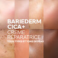 Bariederm Cica+ Repair Cream for Scarring