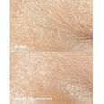 Smart Clinical Repair&trade; Clinique