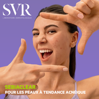 SVR